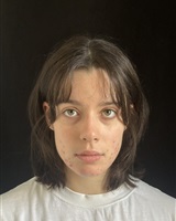 Pola face acné<br />&copy; Rany DOMENECH