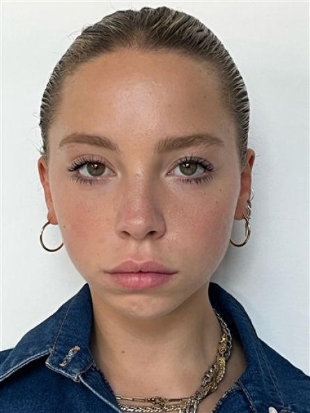 Alt
